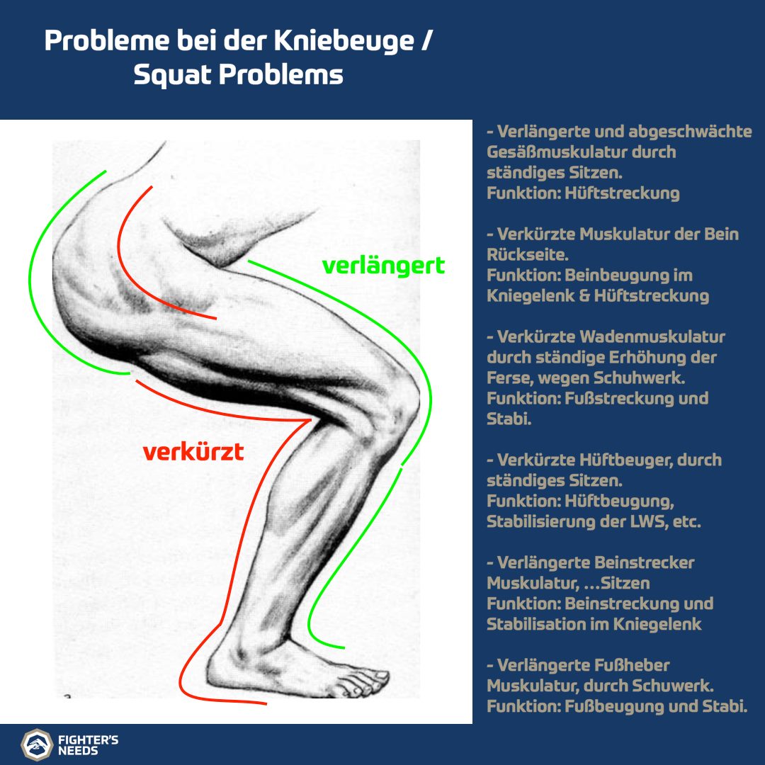 You are currently viewing Probleme bei der Kniebeuge